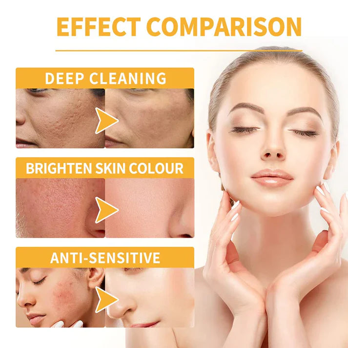 THE VIRAL EELHOE HONEY TEARING MASK