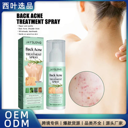 Back Acne Treatment Spray