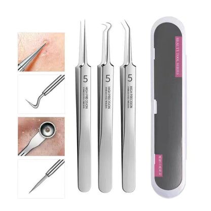 Acne Blackhead Removal Tool Kit