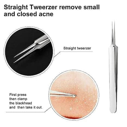 Acne Blackhead Removal Tool Kit