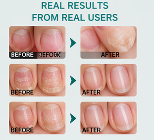 ANTI-FUNGAL NAIL REPAIR POLISH