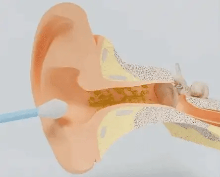 Smart Ear Cleaning Swab