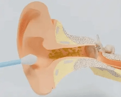 Smart Ear Cleaning Swab